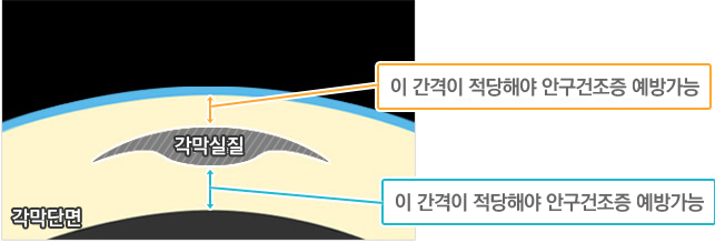 라식이미지