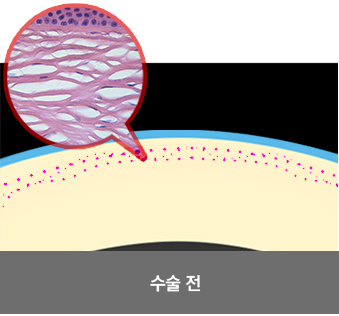 라식이미지