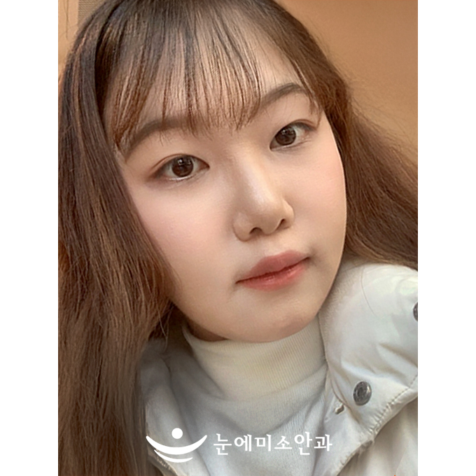 운동이나 일상생활을 할 때 안경이 없는 것이 너무 편했습니다. 안경을 자주 관리하고 닦아주었는데 이제 그럴필요 없이 맨눈으로 선명히 볼 수 있다는 게 편했습니다.