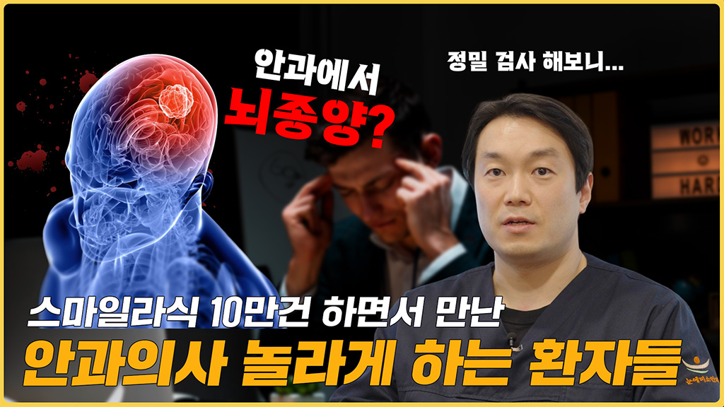 스마일라식 10만안 역대급썰 (ft.뇌종양 방치 환자)