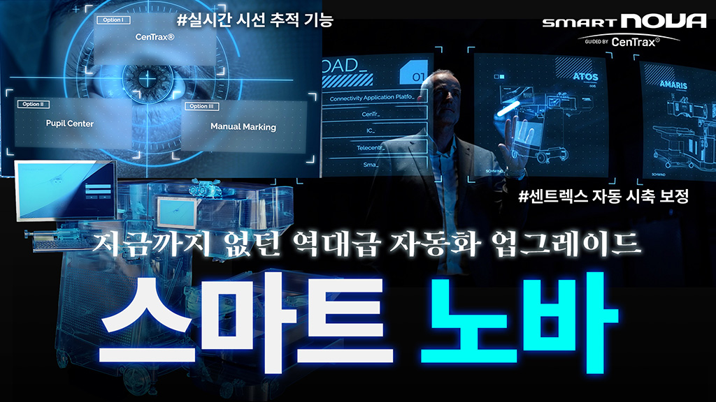 스마트 노바, 스마일라식이 이렇게까지 발전했다고 [스마트 노바] 공식 소개 영상  비전가이드